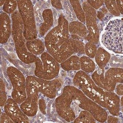 PP2A alpha Antibody, Novus Biologicals:Antibodies:Primary Antibodies