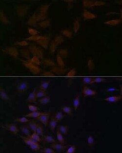 PP2A alpha/beta Rabbit anti-Human, Mouse, Rat, Clone: 4J2Z8, Novus Biologicals