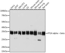 PP2A alpha/beta Rabbit anti-Human, Mouse, Rat, Clone: 4J2Z8, Novus Biologicals