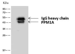 PP2C alpha/PPM1A Antibody, Novus Biologicals:Antibodies:Primary Antibodies