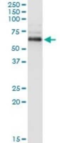 PP2C beta/PPM1B Antibody (1A3-2A4), Novus Biologicals 0.1 mg | Buy Online | Novus Biologicals | Fisher Scientific