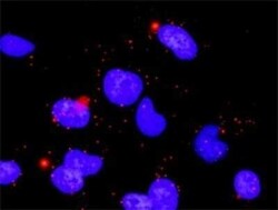 PP2C beta/PPM1B Antibody (1A3-2A4), Novus Biologicals 0.1 mg | Buy Online | Novus Biologicals | Fisher Scientific