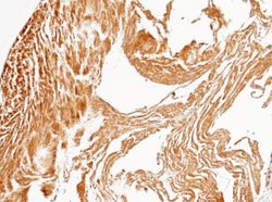 PP2C gamma/PPM1G Rabbit anti-Human, Clone: 112, Novus Biologicals:Antibodies:Primary