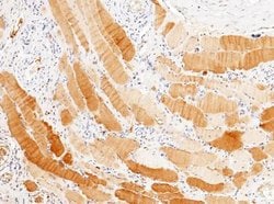 PP2C gamma/PPM1G Rabbit anti-Human, Clone: 112, Novus Biologicals:Antibodies:Primary