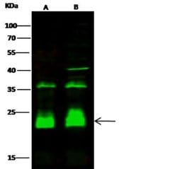 PP2C gamma/PPM1G Rabbit anti-Human, Clone: 112, Novus Biologicals:Antibodies:Primary
