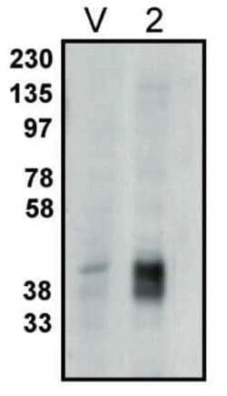 PPAP2C Rabbit anti-Human, Polyclonal, Novus Biologicals 100 &mu;g; Unconjugated:Antibodies,