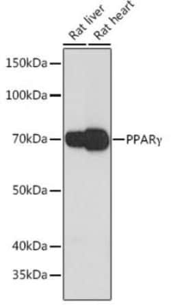 PPAR gamma/NR1C3 Rabbit anti-Rat, Clone: 9P1J6, Novus Biologicals 20 &mu;g | Buy Online | Bio-Techne | Fisher Scientific