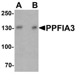 PPFIA3 Antibody - BSA Free, Novus Biologicals 0.1 mg | Buy Online | Novus Biologicals | Fisher Scientific