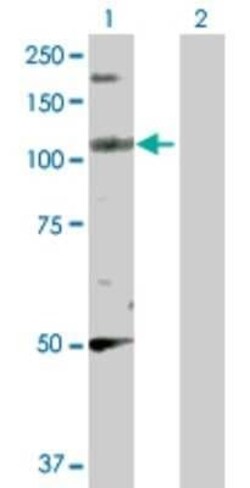 PPFIBP2 Antibody, Novus Biologicals 0.1 mg | Buy Online | Novus Biologicals | Fisher Scientific