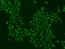 PPHLN1 Antibody, Novus Biologicals 50 &mu;g, Unconjugated:Antibodies, Polyclonal