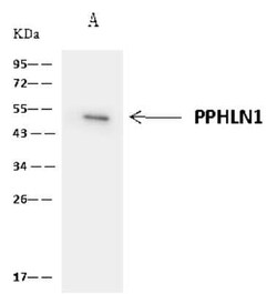 PPHLN1 Antibody, Novus Biologicals 50 &mu;g, Unconjugated:Antibodies, Polyclonal