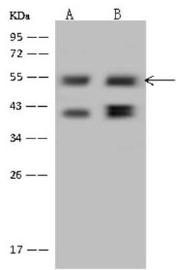 PPHLN1 Antibody, Novus Biologicals 50 &mu;g, Unconjugated:Antibodies, Polyclonal