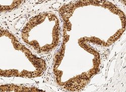 PPIL1 Rabbit anti-Human, Clone: 3, Novus Biologicals 100 &mu;g; Unconjugated:Antibodies,