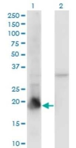 PPIL1 Antibody (2C2), Novus Biologicals 0.1 mg | Buy Online | Novus Biologicals | Fisher Scientific