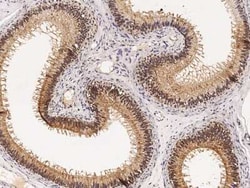 PPIL1 Antibody, Novus Biologicals:Antibodies:Primary Antibodies