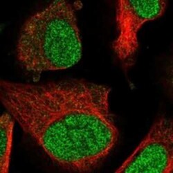 PPM1D Rabbit anti-Human, Polyclonal, Novus Biologicals 25 &mu;g; Unconjugated:Antibodies,