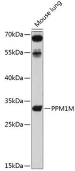 PPM1M Antibody - BSA Free, Novus Biologicals 0.1 mL; Unconjugated:Antibodies,
