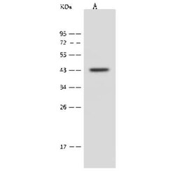 PPME1 Antibody, Novus Biologicals 100 &mu;g; Unconjugated:Antibodies, Polyclonal