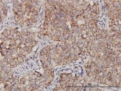PPOX Antibody (2F10), Novus Biologicals 0.1 mg | Buy Online | Novus Biologicals | Fisher Scientific