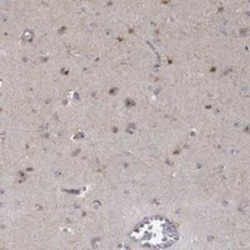 PPP1R16B Rabbit anti-Human, Polyclonal, Novus Biologicals 100 &mu;g; Unconjugated:Antibodies,