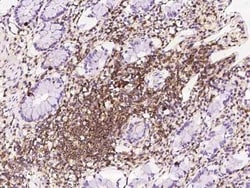 PPP1R18 Antibody, Novus Biologicals:Antibodies:Primary Antibodies