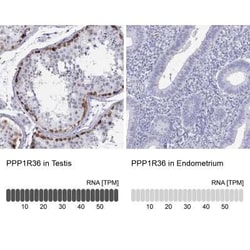 PPP1R36 Antibody, Novus Biologicals 25 &mu;L | Buy Online | Novus Biologicals | Fisher Scientific