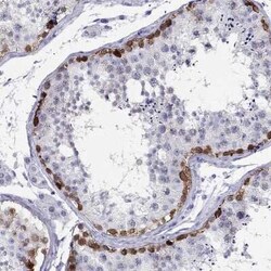 PPP1R36 Antibody, Novus Biologicals 25 &mu;L | Buy Online | Novus Biologicals | Fisher Scientific