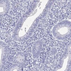PPP1R36 Antibody, Novus Biologicals 25 &mu;L | Buy Online | Novus Biologicals | Fisher Scientific
