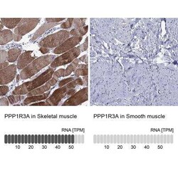 PPP1R3A Rabbit anti-Human, Polyclonal, Novus Biologicals 25 &mu;g; Unconjugated:Antibodies,
