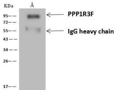 PPP1R3F Antibody, Novus Biologicals 100 &mu;g; Unconjugated:Antibodies,