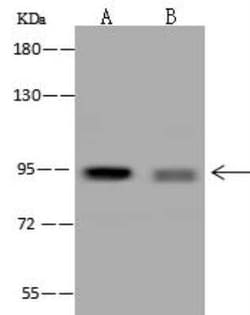 PPP1R3F Antibody, Novus Biologicals 100 &mu;g; Unconjugated:Antibodies,