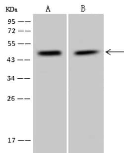 PPP1R7 Antibody, Novus Biologicals 50 &mu;g | Buy Online | Novus Biologicals | Fisher Scientific