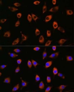PPP1R9B/Spinophilin Antibody - Azide and BSA Free, Novus Biologicals 0.1