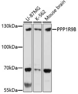 PPP1R9B/Spinophilin Antibody - Azide and BSA Free, Novus Biologicals 0.1