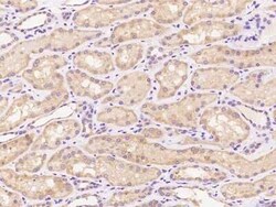 PPP2R2A Antibody, Novus Biologicals:Antibodies:Primary Antibodies