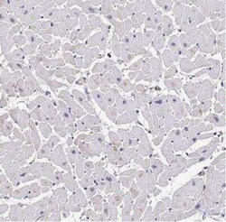 PPP2R2B Antibody, Novus Biologicals 25 &mu;L, Unconjugated:Antibodies,