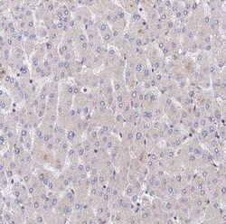 PPP2R2B Antibody, Novus Biologicals 25 &mu;L, Unconjugated:Antibodies,