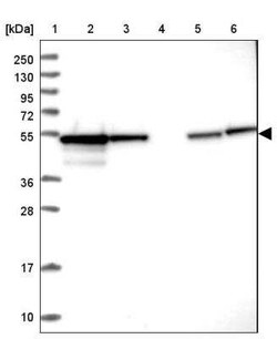 PPP2R2B Antibody, Novus Biologicals 25 &mu;L, Unconjugated:Antibodies,