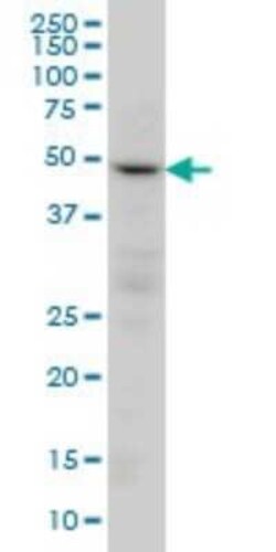 PPP2R2C Antibody (6D1), Novus Biologicals 0.1 mg | Buy Online | Novus Biologicals | Fisher Scientific