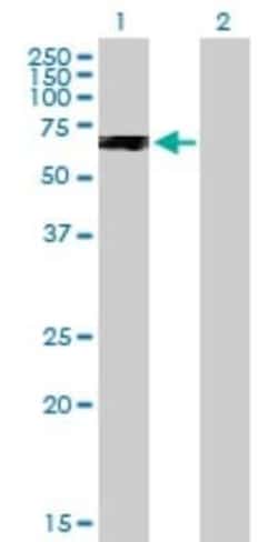 PPP2R2C Antibody, Novus Biologicals 0.05 mg; Unconjugated:Antibodies, Polyclonal