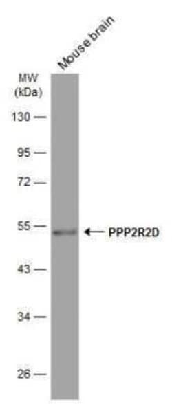 PPP2R2D Antibody (GT577), Novus Biologicals 100 &mu;g | Buy Online | Novus Biologicals | Fisher Scientific