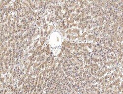 PPP2R2D Antibody, Novus Biologicals 100 &mu;g | Buy Online | Novus Biologicals | Fisher Scientific