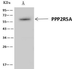 PPP2R5A Antibody, Novus Biologicals 100 &mu;g | Buy Online | Novus Biologicals | Fisher Scientific
