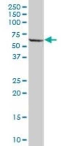 PPP2R5A Antibody, Novus Biologicals 50 &mu;g | Buy Online | Novus Biologicals | Fisher Scientific