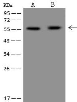 PPP2R5A Antibody, Novus Biologicals 100 &mu;g | Buy Online | Novus Biologicals | Fisher Scientific