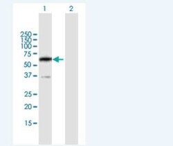 PPP2R5B Antibody, Novus Biologicals 50 &mu;g | Buy Online | Novus Biologicals | Fisher Scientific