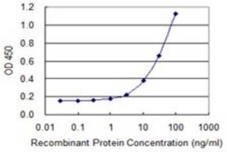 PPP2R5D Antibody (4E12), Novus Biologicals 0.1 mg | Buy Online | Novus Biologicals | Fisher Scientific