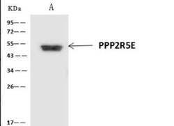 PPP2R5E Antibody, Novus Biologicals:Antibodies:Primary Antibodies