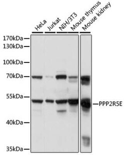 PPP2R5E Antibody - Azide and BSA Free, Novus Biologicals:Antibodies:Primary