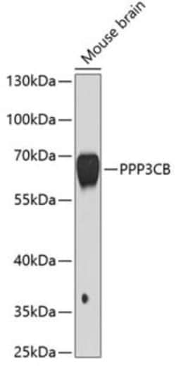 PPP3CB Antibody - BSA Free, Novus Biologicals 0.02 mL; Unconjugated:Antibodies,